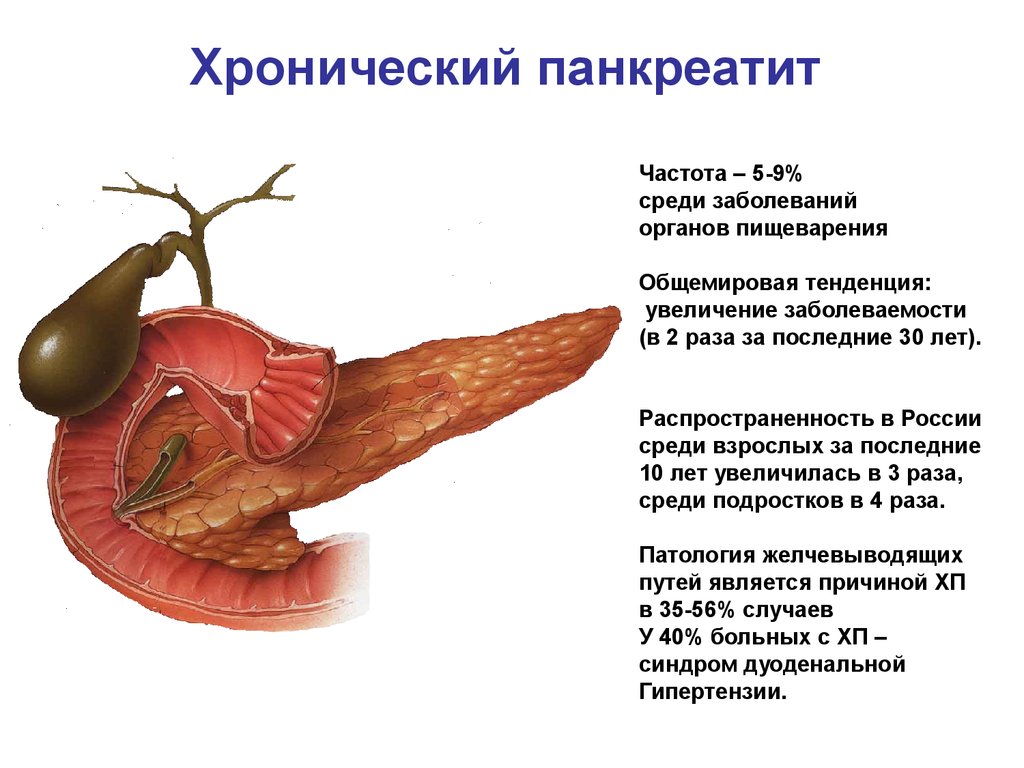 Панкреатит: что нужно знать о хронической форме
