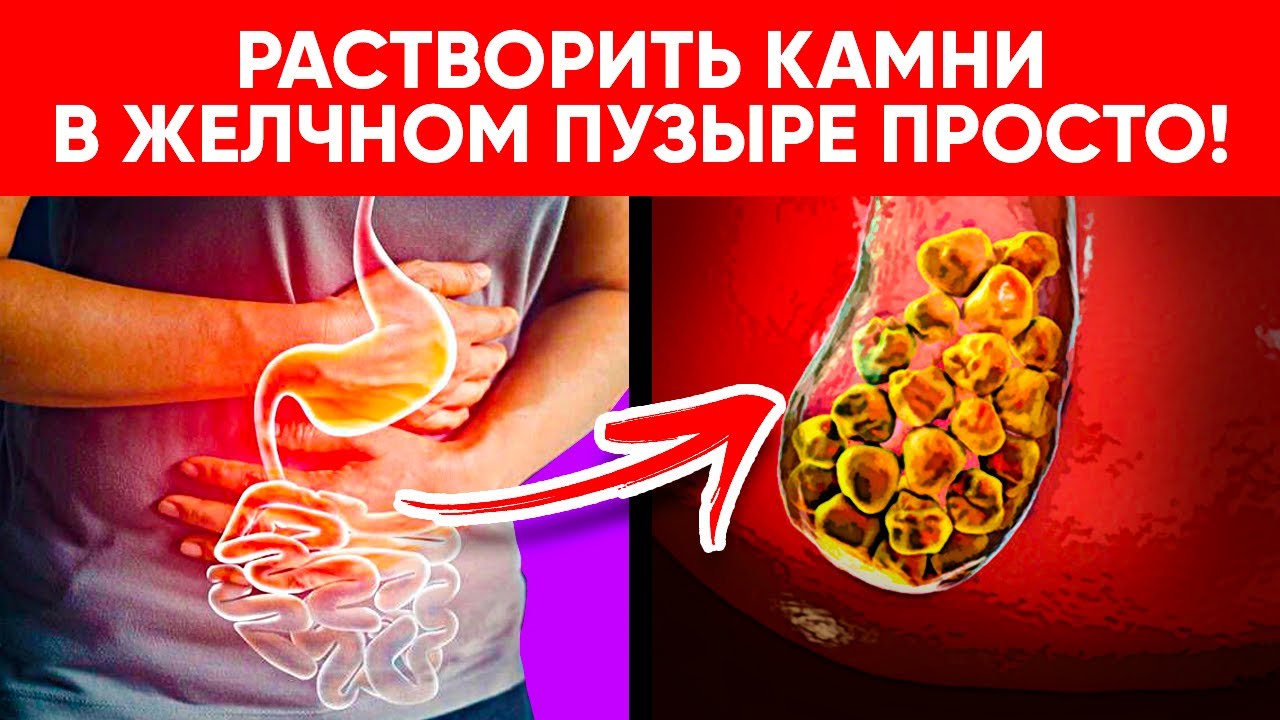 Панкреатит и камни в желчном пузыре: как связаны?