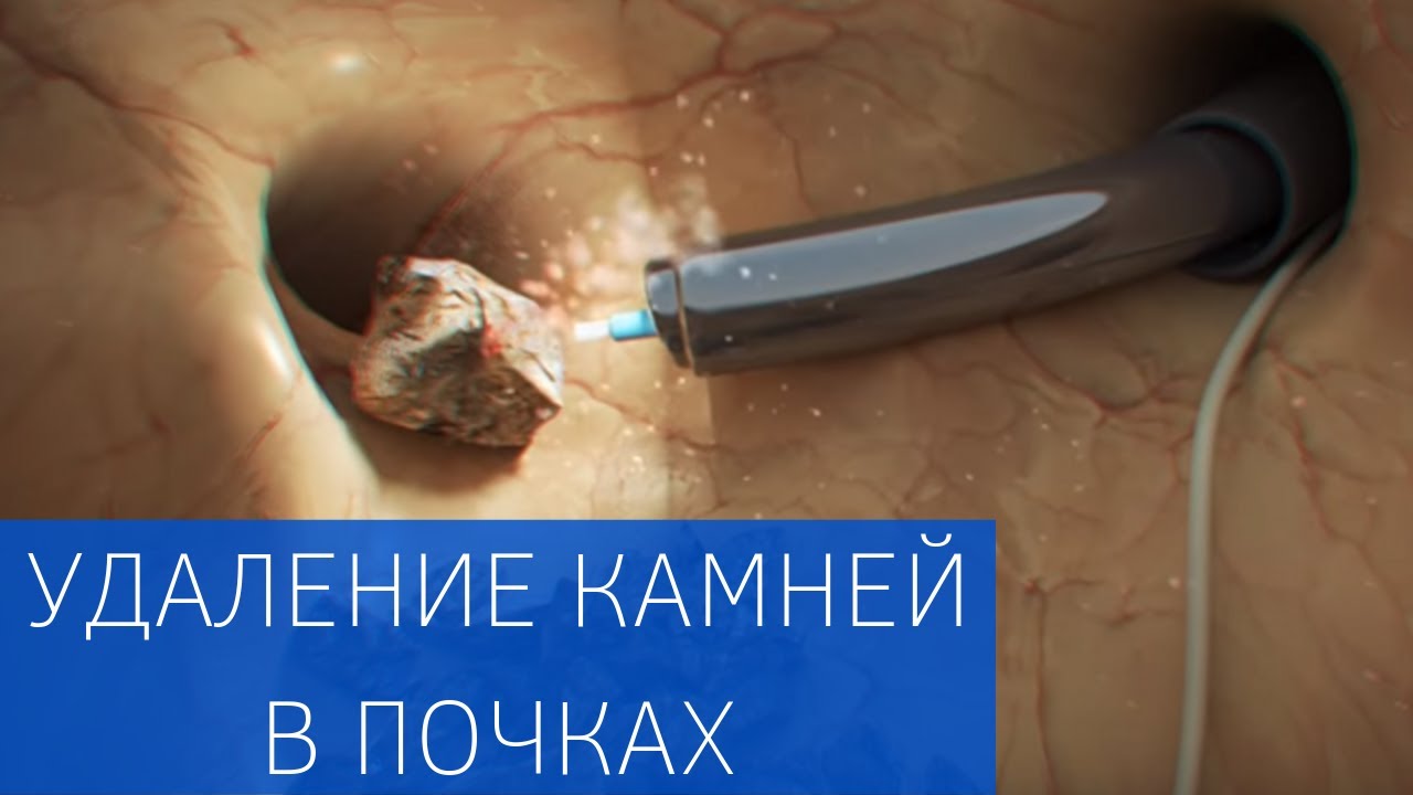 Панкреатит у детей: особенности и лечение