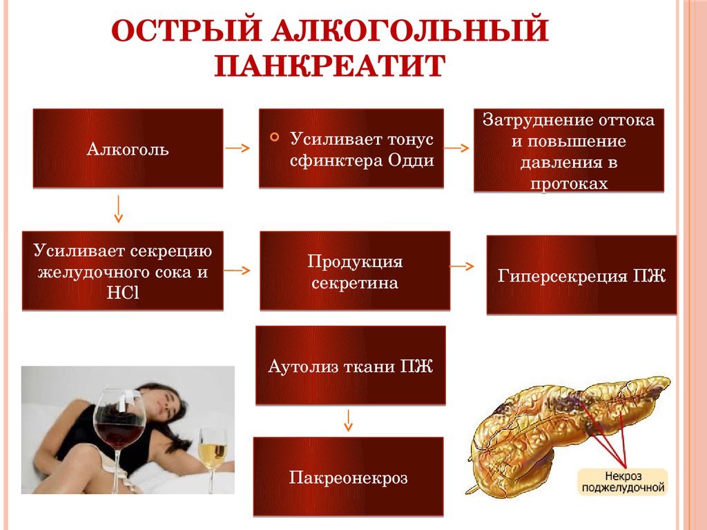 Роль алкоголя в развитии панкреатита