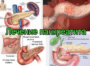 Панкреатит: какие виды операций применяются при лечении