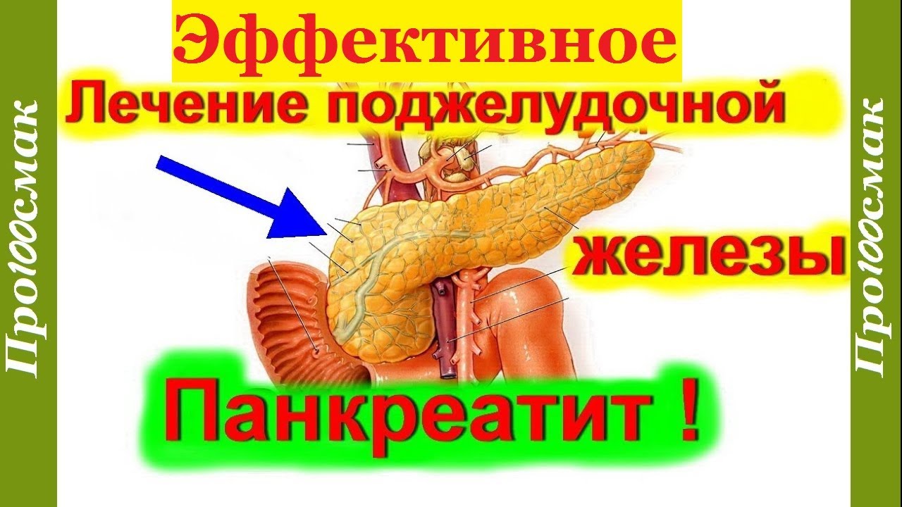 Как предотвратить панкреатит: полезные советы