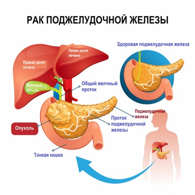 функциональные тесты призваны оценить экскреторную функцию поджелудочной железы. выделяют прямые (зондовые) и непрямые исследования.