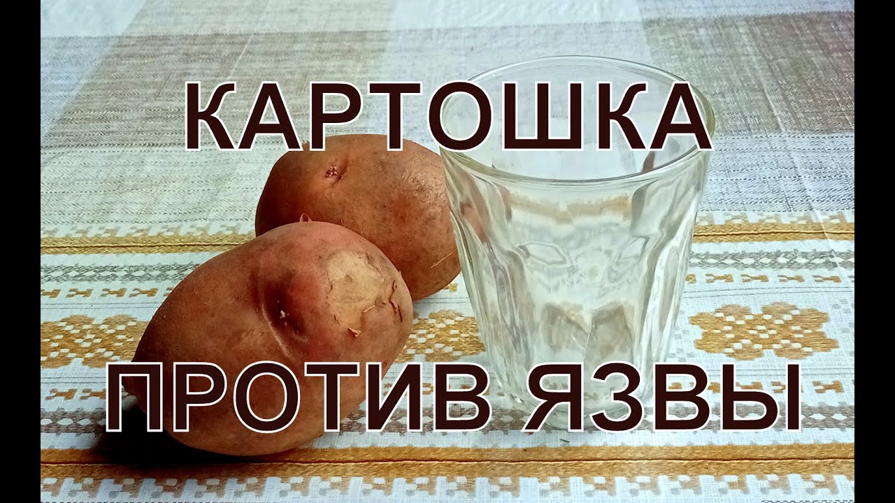 картофельный сок при улалении жёлчного пузыря