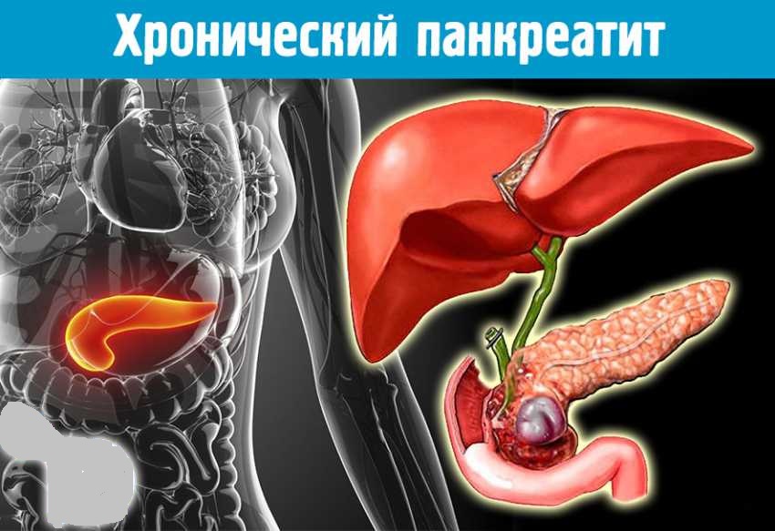 отвар каких трав нужно пить при обострении хронического панкреатита
