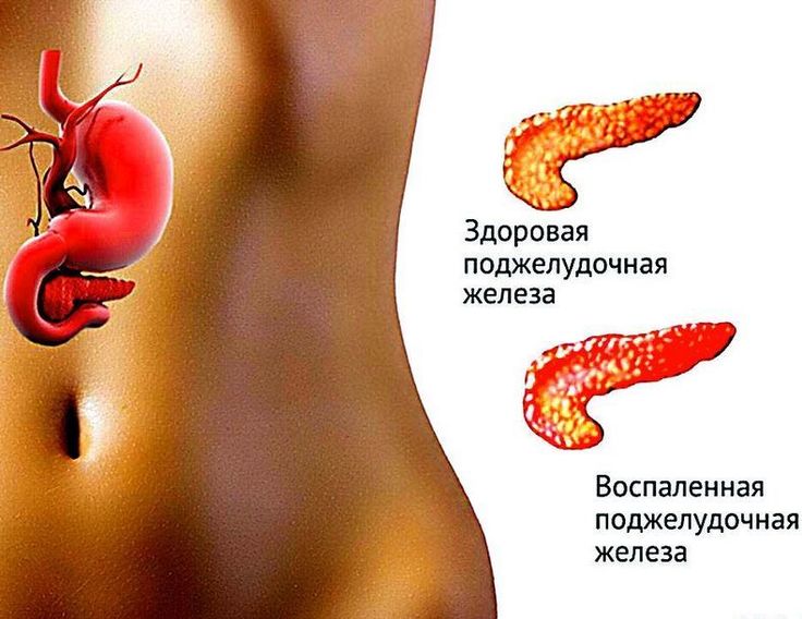 как лечить поджелудочную мёдом отзывы