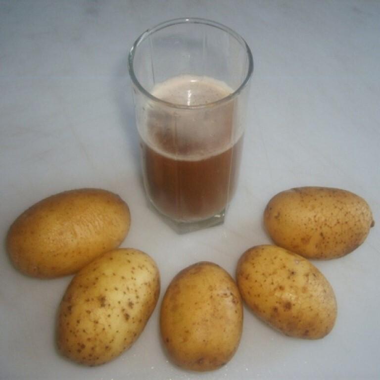 можно ли картофельный сок при холецистите