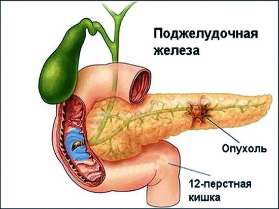 лечение поджелудочной прополисом