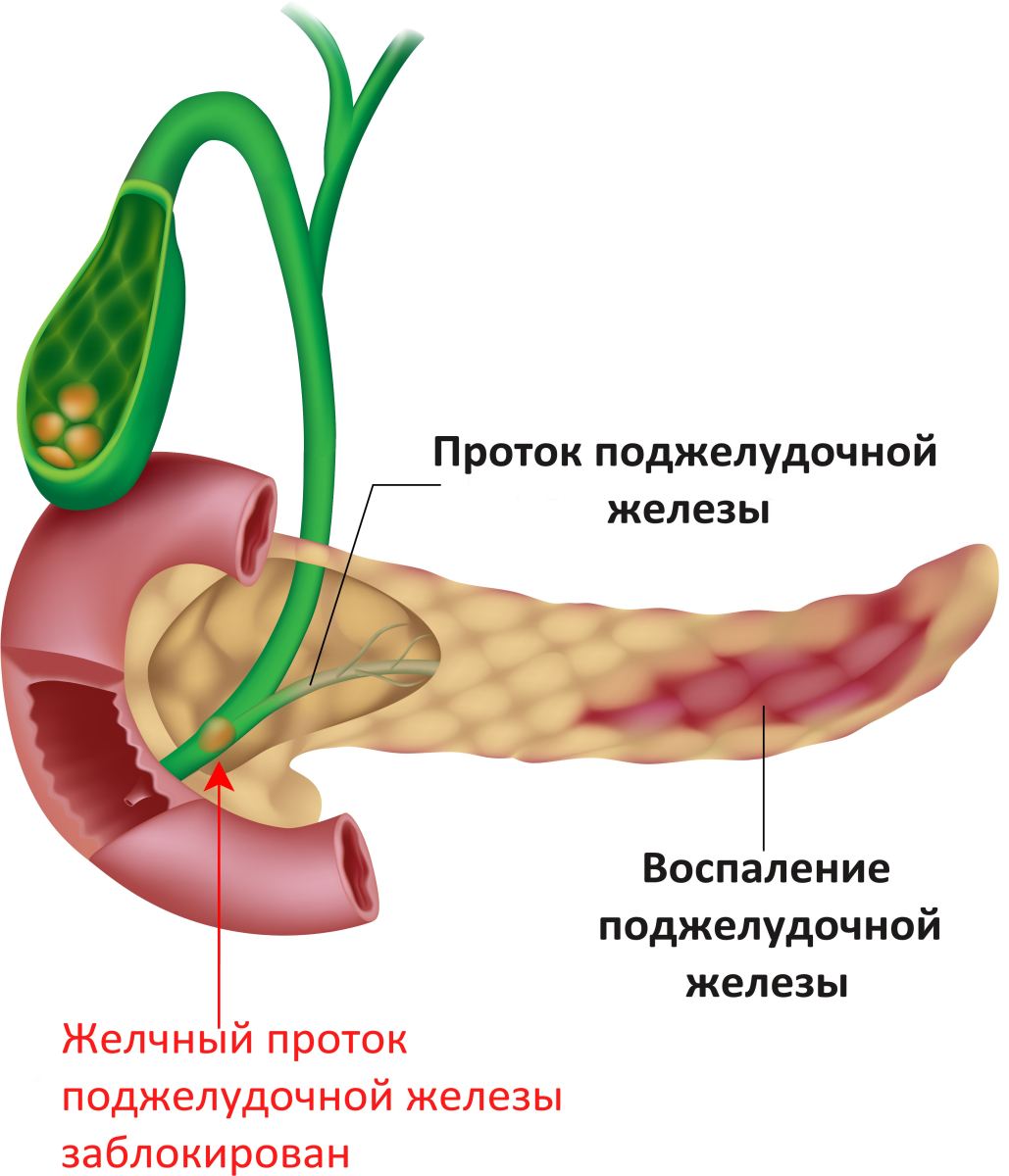 персик при панкреатите можно или нет